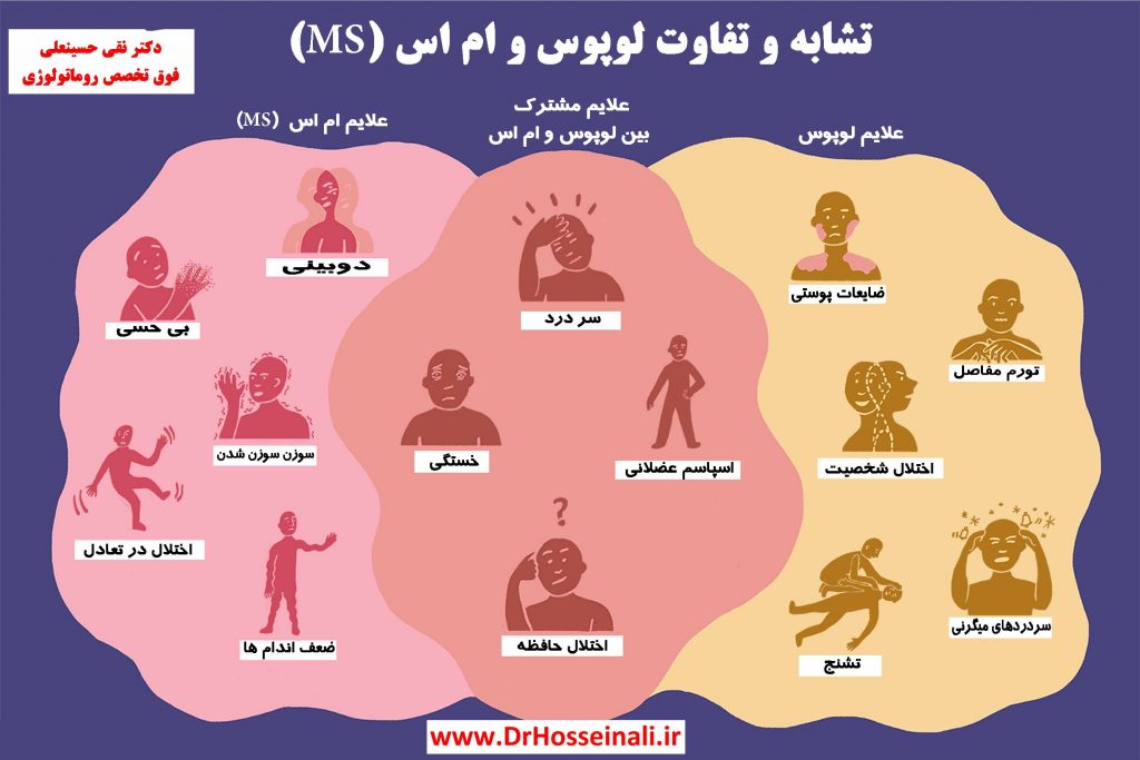 تفاوت لوپوس و ام اس MS MS vs. lupus