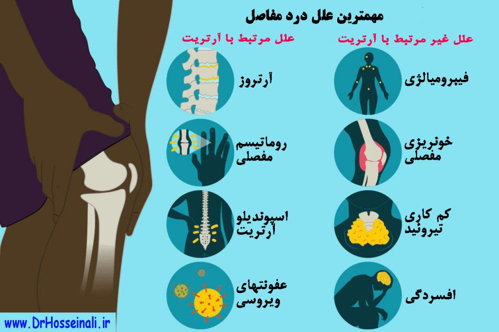 درد مفاصل دکتر نقی حسینعلی , بهترین فوق تخصص درد دکتر نقی حسینعلی , علت بدن درد , فیبرومیالژی 